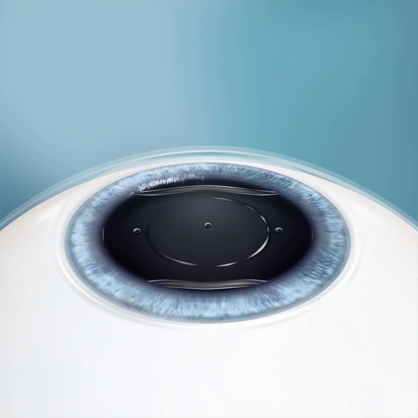 STAAR_EVO_Illu_Serie_02_ia