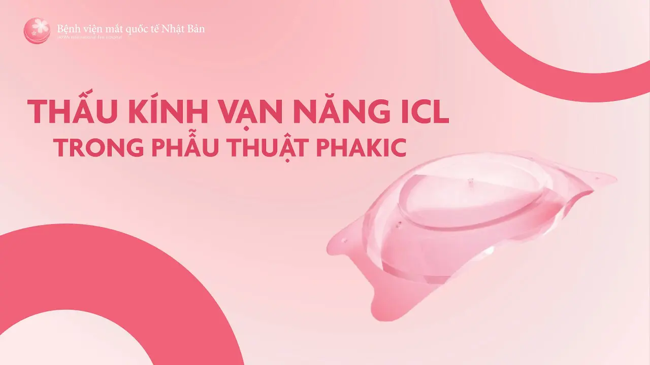 Thấu kính vạn năng ICL trong phẫu thuật Phakic