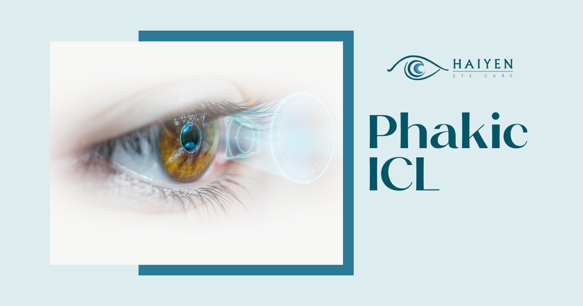 Từ 6 Độ Cận Đến Tự Do Không Kính – Phakic ICL Giúp Bạn Nhìn Rõ Ràng