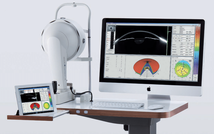 Máy chụp bản đồ giác mạc hiện đại giúp bác sĩ xác định chính xác độ dày và hình dạng giác mạc trước khi điều trị.