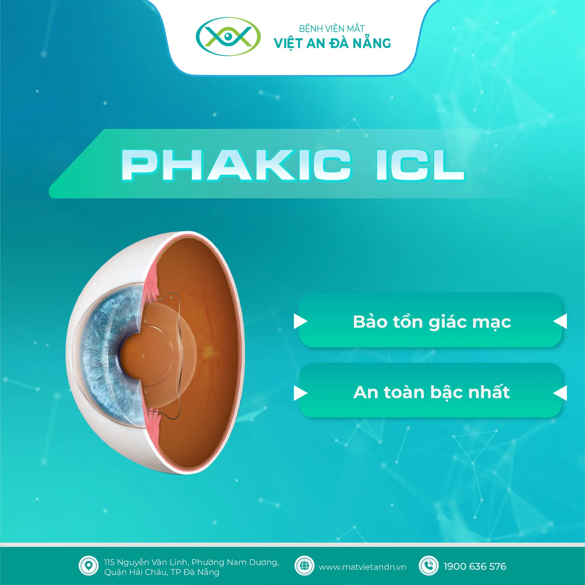 Phakic ICL – bước tiến hiện đại trong điều trị cận thị