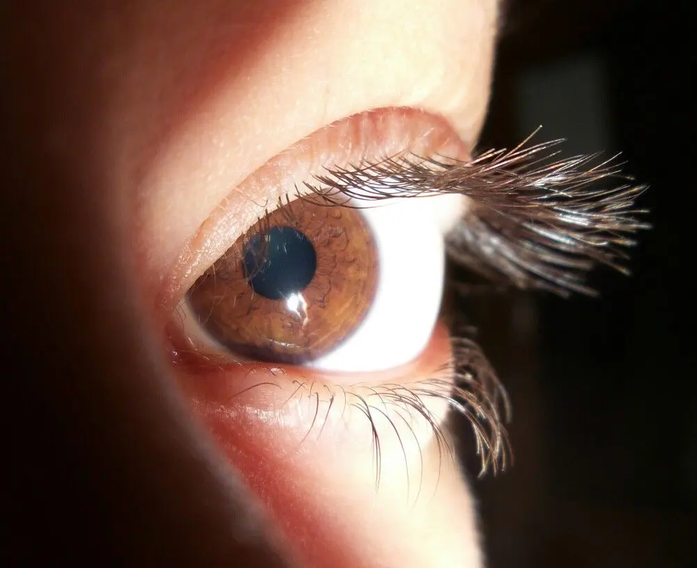 Dry eyes reduce distance vision and cause temporary blurriness.