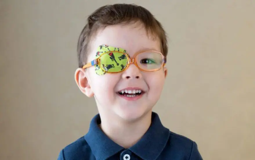 Thực trạng mắt lười ở trẻ em hiện nay