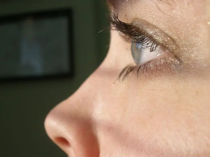 Các giai đoạn hồi phục thị lực sau mổ cận phakic