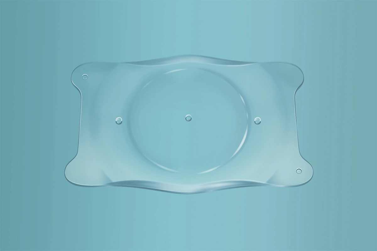 Phakic ICL lenses come with a lifetime warranty, optimizing Phakic ICL cost and ensuring long-term peace of mind