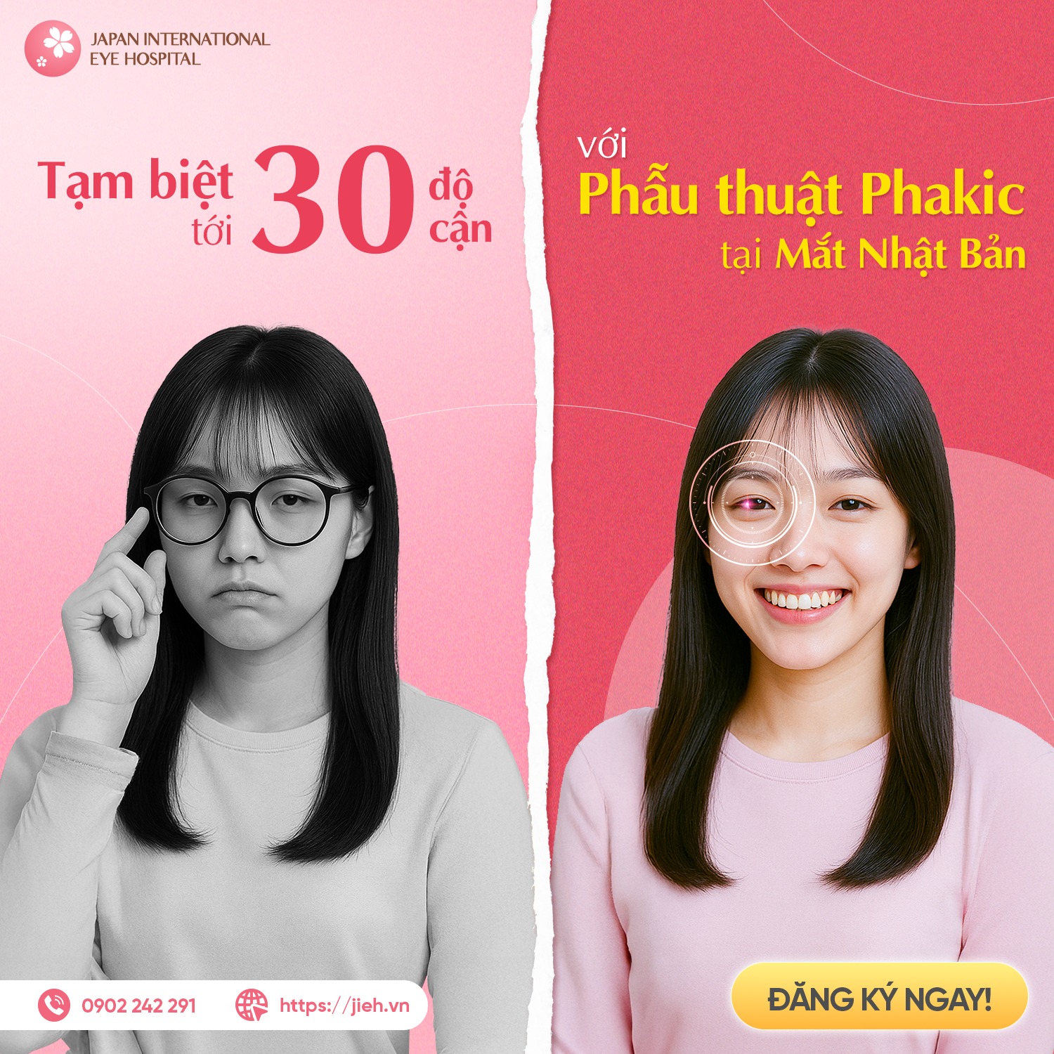 Phakic ICL – Solution to eliminate up to 30 diopters at Japan International Eye Hospital