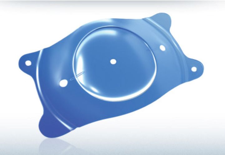 Key benefits of Phakic ICL for high myopia patients