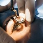 Những điều tuyệt đối không nên làm sau mổ cận để tránh sẹo