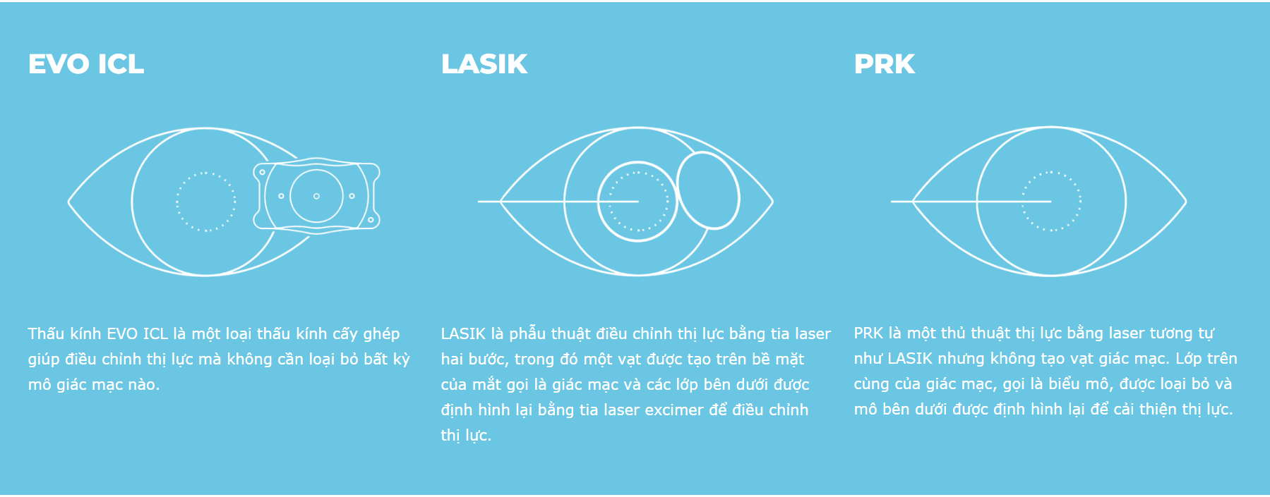 So sánh giữa EVO ICL, Lasik và PRK