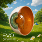 So sánh tốc độ hồi phục giữa Phakic ICL và LASIK