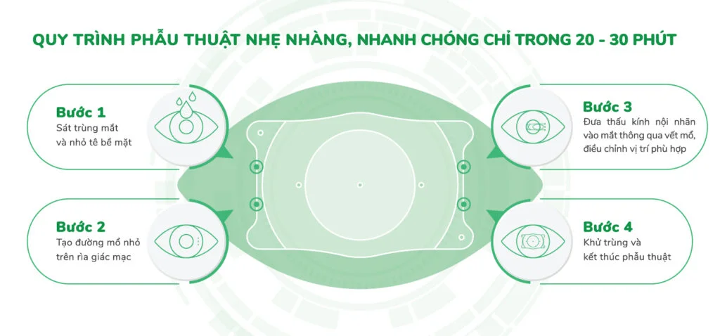 Phakic ICL surgery procedure
