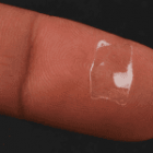 Thời gian chờ kính và phẫu thuật Phakic ICL mất bao lâu?