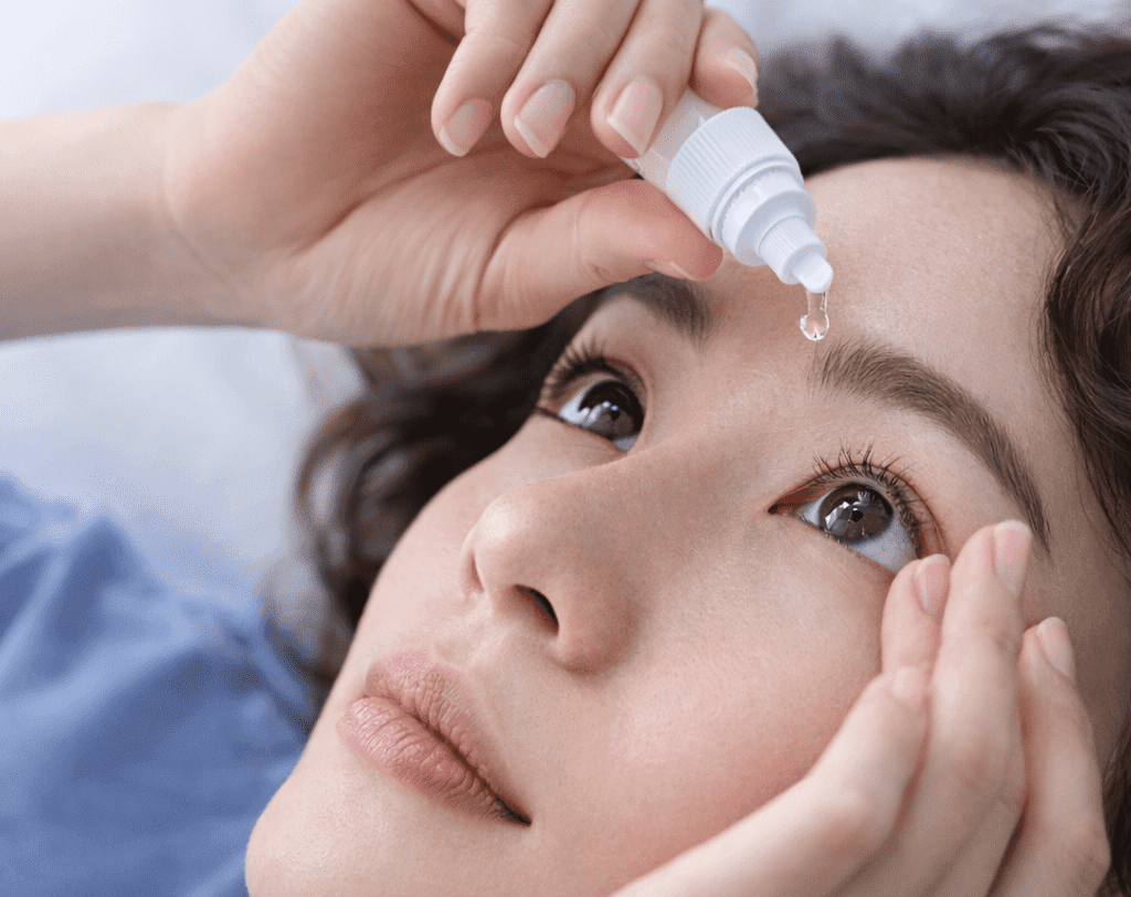 Sử dụng thuốc nhỏ mắt để giữ độ ẩm sau mổ mắt cận