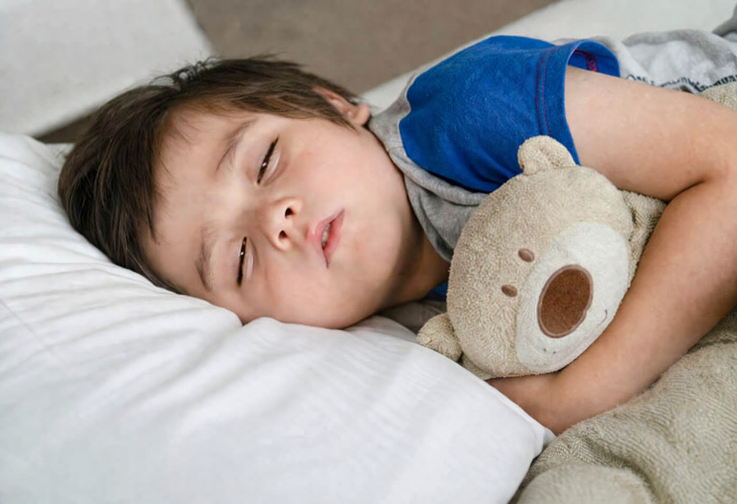 In individuals whose eyelids do not fully close, the cornea is exposed to air during sleep, leading to localized dryness.