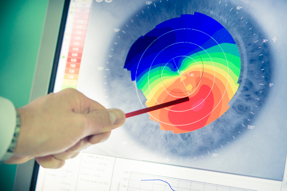 Corneal thickness measurement helps determine the appropriate treatment method