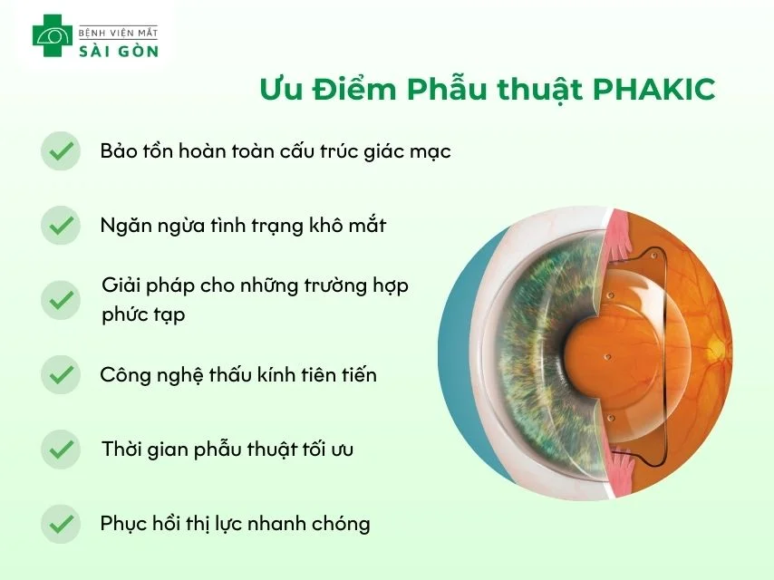 Ưu điểm của phẫu thuật Phakic ICL