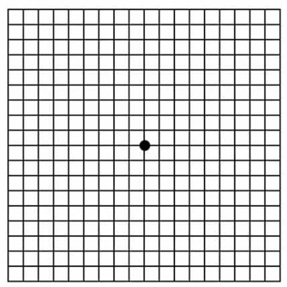Parallel lines can help identify the degree of astigmatism
