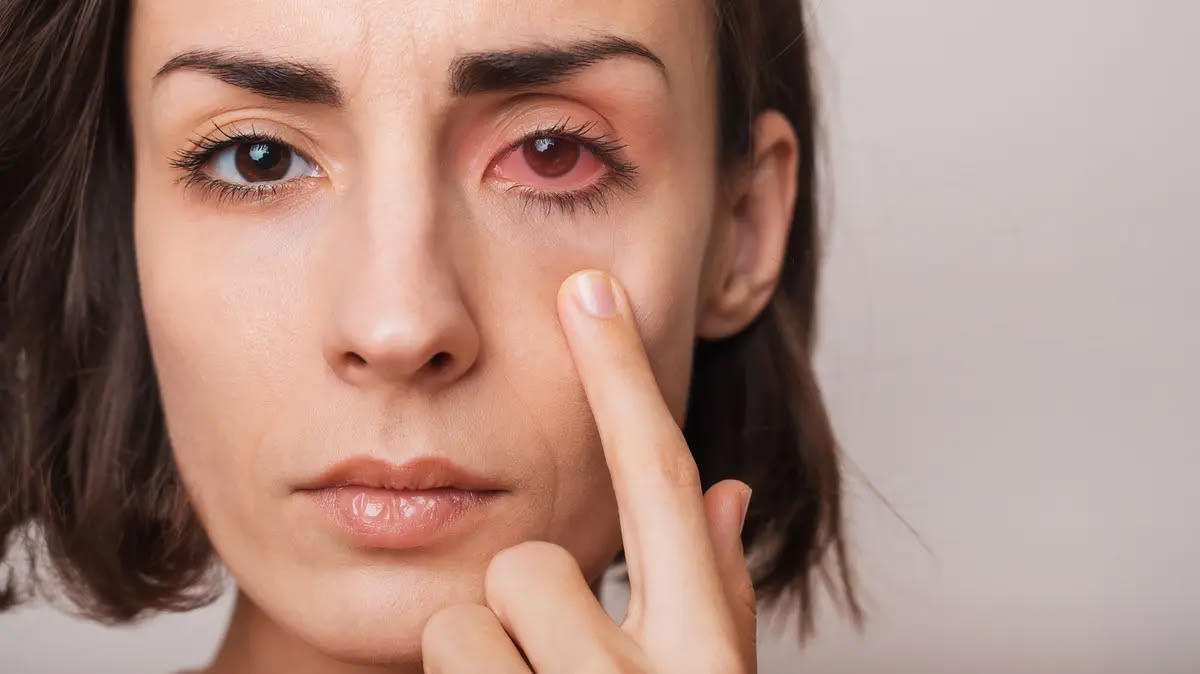 Vì sao nước muối sinh lý giúp giảm khó chịu khi bị đau mắt đỏ?