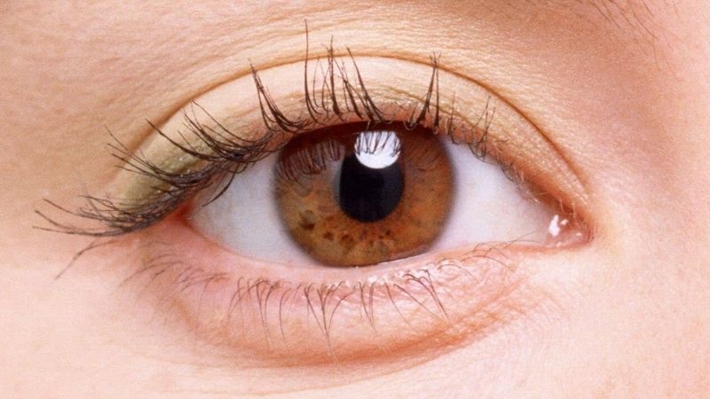Phẫu thuật Phakic ICL trong điều trị loạn thị