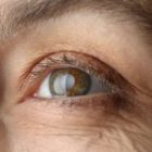 Retinitis Pigmentosa: Causes, Symptoms and Treatment